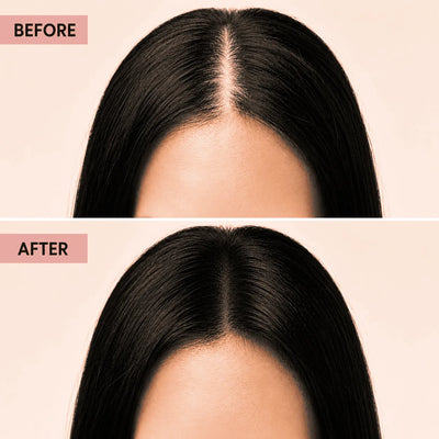 Korean Scalp Revival Bar