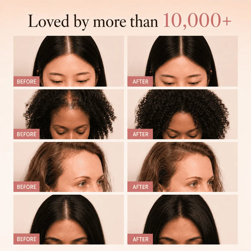 Korean Scalp Revival Bar