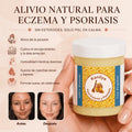 Kanilya - Bálsamo reparador para eczema y psoriasis