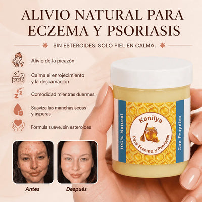 Kanilya - Bálsamo reparador para eczema y psoriasis