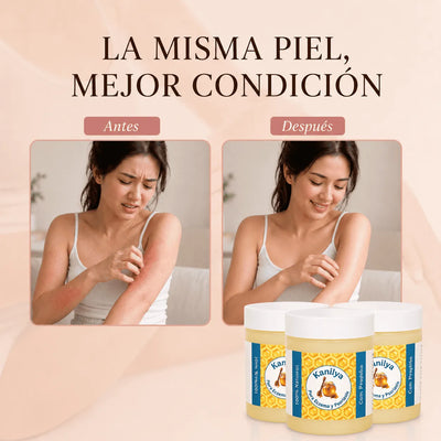 Kanilya - Bálsamo reparador para eczema y psoriasis