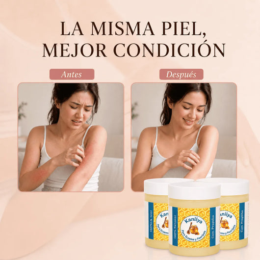 Kanilya - Bálsamo reparador para eczema y psoriasis