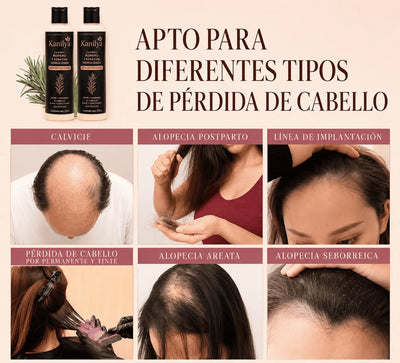 Champú de Romero Tgideas