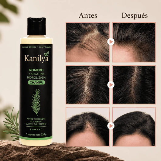 Champú de Romero Tgideas