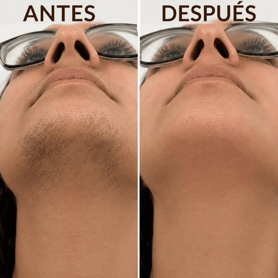 Detiene el crecimiento del vello de forma natural