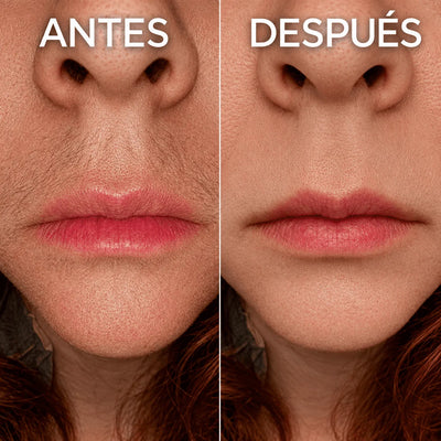Detiene el crecimiento del vello de forma natural