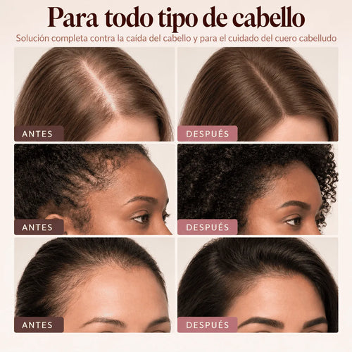 Un cabello más largo, fuerte y denso en 6 semanas