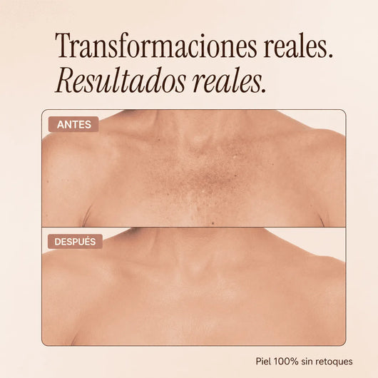 Perfeccionador Corporal