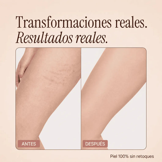 Perfeccionador Corporal
