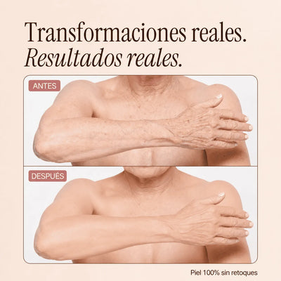 Perfeccionador Corporal