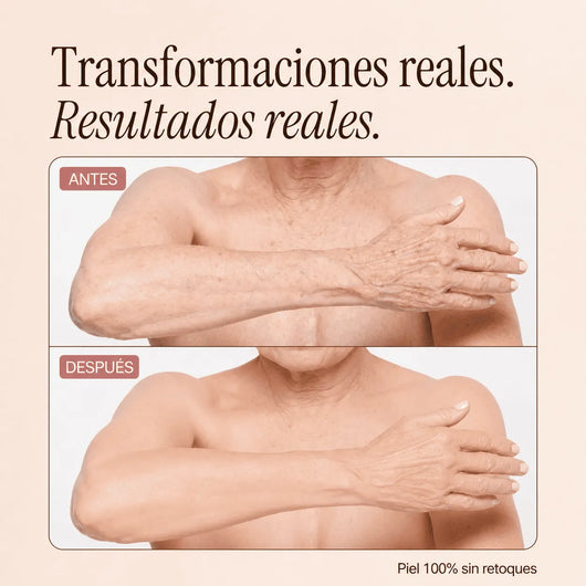 Perfeccionador Corporal