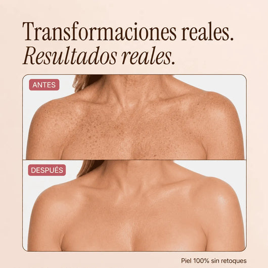 Perfeccionador Corporal