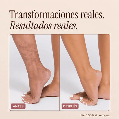 Perfeccionador Corporal