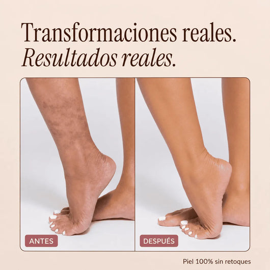 Perfeccionador Corporal