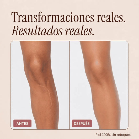 Perfeccionador Corporal