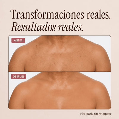 Perfeccionador Corporal