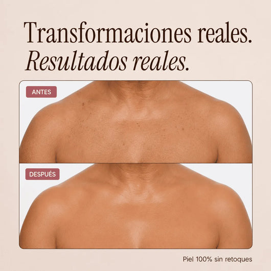 Perfeccionador Corporal