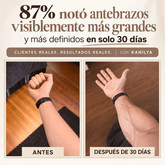 Entrenador de antebrazos Kanilya